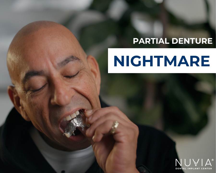 How Much Are Dentures 2025 Guide How much are dentures 2025 guide